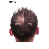 Complex Biberiye Saç Bakım Yağı 50 ml
